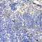 Bruton Tyrosine Kinase antibody, A1576, ABclonal Technology, Immunohistochemistry paraffin image 
