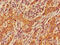 Ceramide Kinase antibody, CSB-PA005256LA01HU, Cusabio, Immunohistochemistry paraffin image 