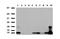 S100 Calcium Binding Protein A9 antibody, UM800067, Origene, Western Blot image 