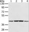 Phosphoribosylaminoimidazole Carboxylase And Phosphoribosylaminoimidazolesuccinocarboxamide Synthase antibody, LS-C405229, Lifespan Biosciences, Western Blot image 