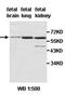 Adrenocortical dysplasia protein antibody, orb77687, Biorbyt, Western Blot image 