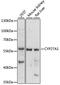 Sterol 26-hydroxylase, mitochondrial antibody, 18-429, ProSci, Western Blot image 