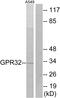 Probable G-protein coupled receptor 32 antibody, A13621, Boster Biological Technology, Western Blot image 