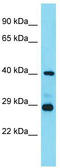 LHFPL Tetraspan Subfamily Member 3 antibody, TA334114, Origene, Western Blot image 