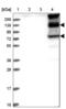 Inter-Alpha-Trypsin Inhibitor Heavy Chain 1 antibody, NBP1-81782, Novus Biologicals, Western Blot image 