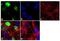 Myogenic Differentiation 1 antibody, MA5-12902, Invitrogen Antibodies, Immunofluorescence image 