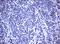 MDM2 Proto-Oncogene antibody, M00054-1, Boster Biological Technology, Immunohistochemistry paraffin image 