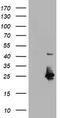 Ubiquitin Conjugating Enzyme E2 E3 antibody, TA504680S, Origene, Western Blot image 