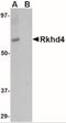 Mex-3 RNA Binding Family Member A antibody, NBP2-41092, Novus Biologicals, Western Blot image 