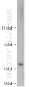 Eukaryotic translation initiation factor 3 subunit E antibody, 11352-1-AP, Proteintech Group, Western Blot image 