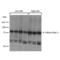 Sodium Channel Epithelial 1 Gamma Subunit antibody, orb67569, Biorbyt, Western Blot image 