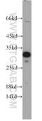 G1/S-specific cyclin-D3 antibody, 10845-1-AP, Proteintech Group, Western Blot image 
