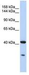 Guanine nucleotide-binding protein G(s) subunit alpha isoforms XLas antibody, ab83735, Abcam, Western Blot image 