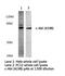 ABL Proto-Oncogene 1, Non-Receptor Tyrosine Kinase antibody, LS-C175890, Lifespan Biosciences, Western Blot image 