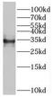 Radial Spoke Head 9 Homolog antibody, FNab07510, FineTest, Western Blot image 