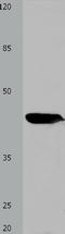 CCN2 antibody, TA323092, Origene, Western Blot image 