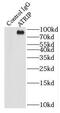 ATR-interacting protein antibody, FNab00738, FineTest, Immunoprecipitation image 