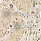 CD40 Molecule antibody, A0218, ABclonal Technology, Immunohistochemistry paraffin image 