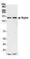 Regulatory Associated Protein Of MTOR Complex 1 antibody, A300-553A, Bethyl Labs, Western Blot image 