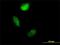S100 Calcium Binding Protein A4 antibody, H00006275-M01, Novus Biologicals, Immunocytochemistry image 