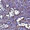 Dihydrolipoamide S-Succinyltransferase antibody, A05097-1, Boster Biological Technology, Immunohistochemistry paraffin image 