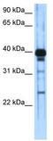 Zinc Finger And SCAN Domain Containing 16 antibody, TA345417, Origene, Western Blot image 