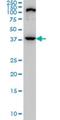 Zinc phosphodiesterase ELAC protein 1 antibody, H00055520-M01, Novus Biologicals, Western Blot image 