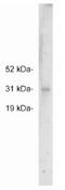 Four And A Half LIM Domains 2 antibody, AP05258PU-N, Origene, Western Blot image 