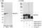 ATP-dependent RNA helicase DDX3X antibody, A300-476A, Bethyl Labs, Western Blot image 