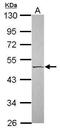 Serpin Family A Member 4 antibody, PA5-31437, Invitrogen Antibodies, Western Blot image 