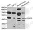 Platelet-derived growth factor D antibody, A8263, ABclonal Technology, Western Blot image 