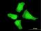 Mitogen-Activated Protein Kinase Kinase 5 antibody, H00005607-M07, Novus Biologicals, Immunocytochemistry image 