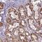 PWWP Domain Containing 2A antibody, NBP2-13833, Novus Biologicals, Immunohistochemistry frozen image 