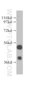 LAP2 alpha antibody, 14651-1-AP, Proteintech Group, Western Blot image 
