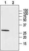 ACTH receptor antibody, TA328604, Origene, Western Blot image 