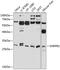 Small Nuclear Ribonucleoprotein Polypeptide B2 antibody, GTX66547, GeneTex, Western Blot image 