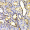 Kinesin-like protein KIF2C antibody, LS-C334067, Lifespan Biosciences, Immunohistochemistry paraffin image 
