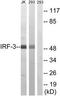 Interferon Regulatory Factor 3 antibody, TA311893, Origene, Western Blot image 