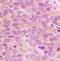 Lymphokine-activated killer T-cell-originated protein kinase antibody, orb393130, Biorbyt, Immunohistochemistry paraffin image 
