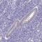 Chromosome 19 Open Reading Frame 81 antibody, HPA060238, Atlas Antibodies, Immunohistochemistry paraffin image 
