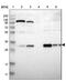 Nitrilase homolog 1 antibody, NBP1-87481, Novus Biologicals, Western Blot image 