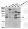 Glycoprotein IX Platelet antibody, A5374, ABclonal Technology, Western Blot image 