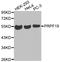 Pre-mRNA-processing factor 19 antibody, STJ25160, St John