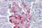 Proprotein Convertase Subtilisin/Kexin Type 1 antibody, ARP33848_P050, Aviva Systems Biology, Immunohistochemistry paraffin image 