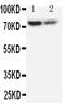 ABCD3 antibody, GTX12314, GeneTex, Western Blot image 