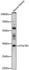 Cysteinyl Leukotriene Receptor 2 antibody, 16-655, ProSci, Western Blot image 