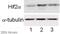 HIF-2-alpha antibody, ab199, Abcam, Western Blot image 