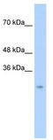 Chymotrypsin Like antibody, TA334672, Origene, Western Blot image 