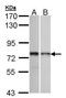 Zinc Finger Protein 398 antibody, TA308252, Origene, Western Blot image 
