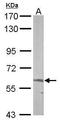 5'-Aminolevulinate Synthase 2 antibody, GTX104139, GeneTex, Western Blot image 